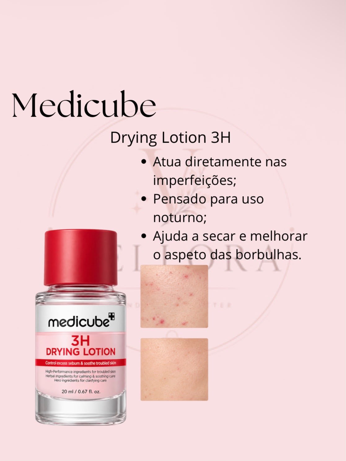 Medicube Drying Lotion 3H